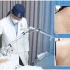 Tạm biệt da lưng sần thâm, viêm nang lông kéo dài: Vì sao nhiều khách hàng lựa chọn Phòng khám Da liễu LG?
